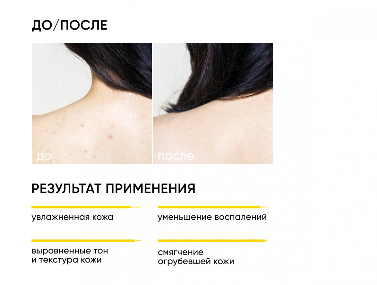 Обновляющий крем для тела с кислотами Skin Renewal / Skin Renewal Body Cream
